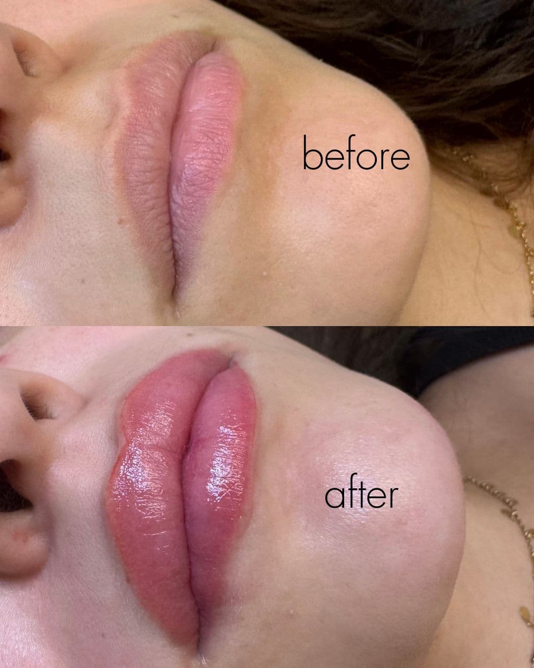 Lip Blushing